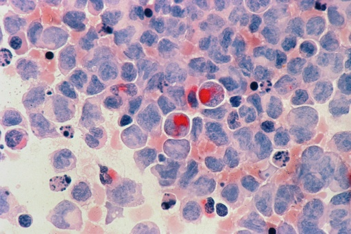 [ABC-K3940] Mouse Splenocytes CD8+ T Cell Isolation Kit   -1 Kit